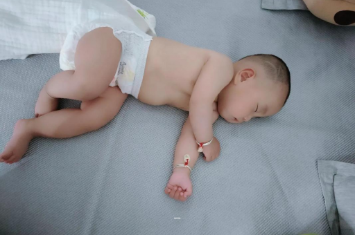 阿拉尔宝宝脸上有白色斑块